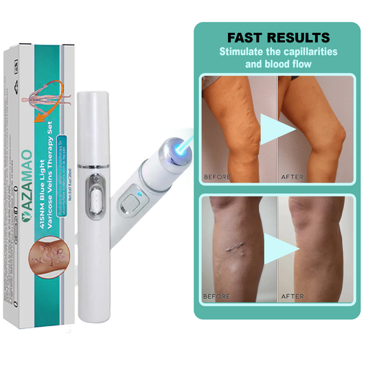 Blue Light Varicose Veins Therapy